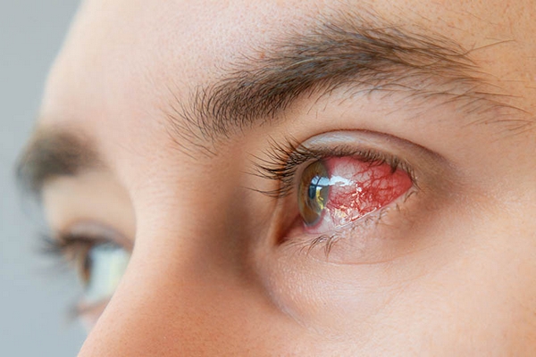 Заболевания сетчатки глаза и их лечение