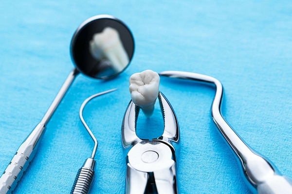 Удаление зуба мудрости: когда и почему важно обратиться к специалисту