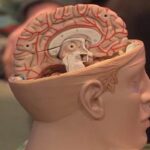 Нейропластичность мозга: как человек адаптируется после удаления полушария